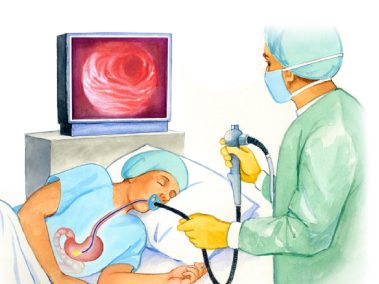 Nội soi dạ dày và đại tràng
