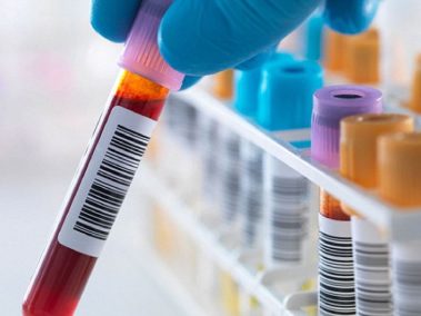 Xét nghiệm sinh hóa, miễn dịch, vi sinh và các marker ung thư